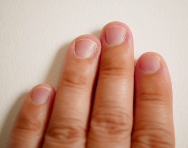 噛み爪をジェルネイルで美しく！爪を噛む癖を治す方法はある？