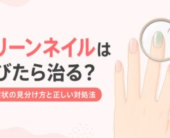 グリーンネイルは伸びたら治る？初期症状の見分け方と正しい対処法