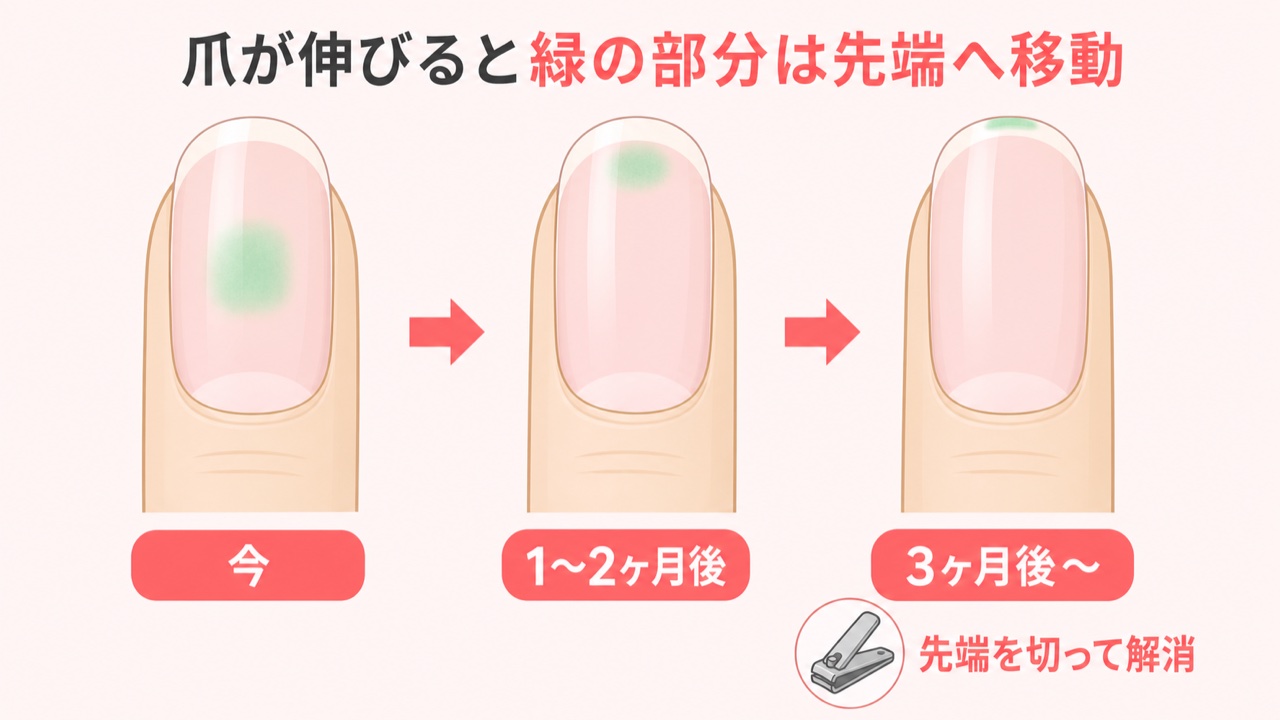爪が伸びるとグリーンネイルの緑の部分が先端へ移動する経過図