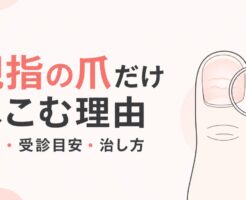 親指の爪だけへこむのはなぜ？原因・受診目安と治し方を表すアイキャッチ画像