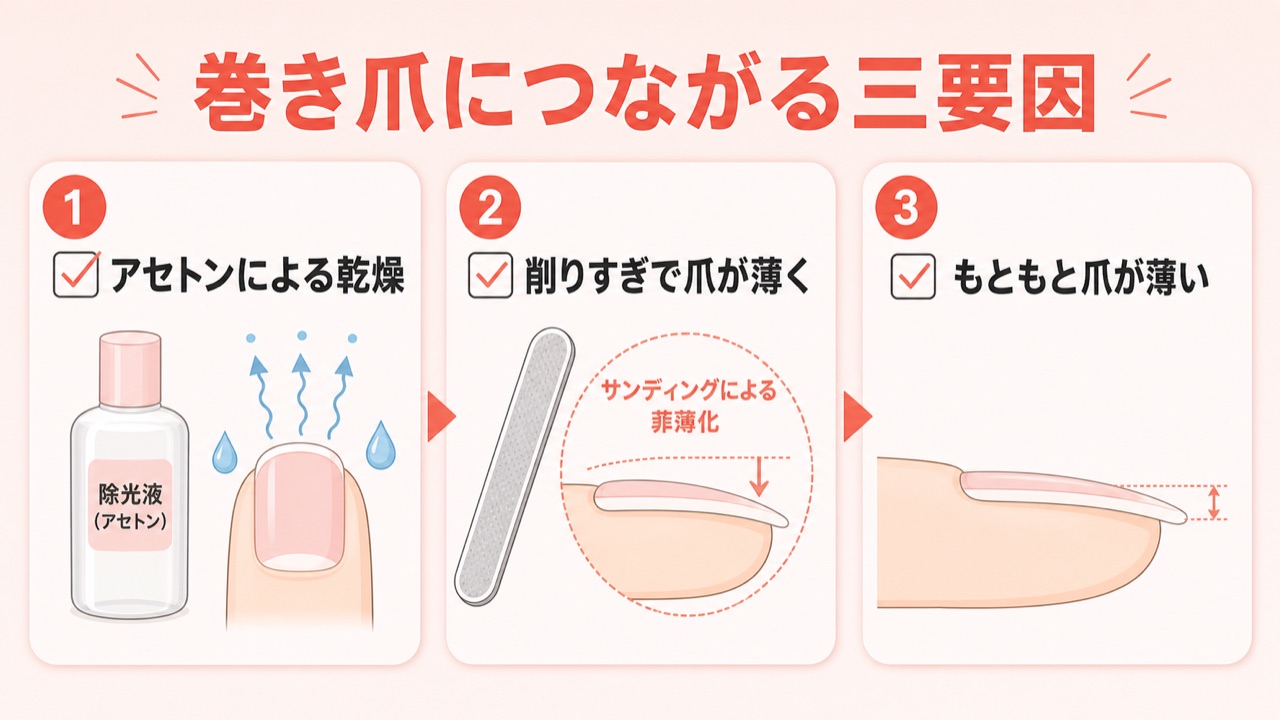 セルフジェルネイルで巻き爪になる3つの原因チェックリスト