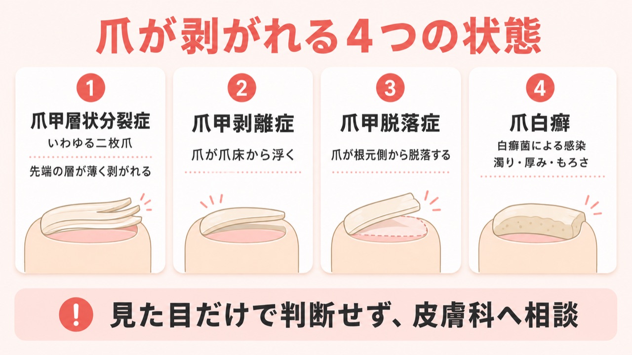 爪が剥がれる症状別の原因4分類の比較図解