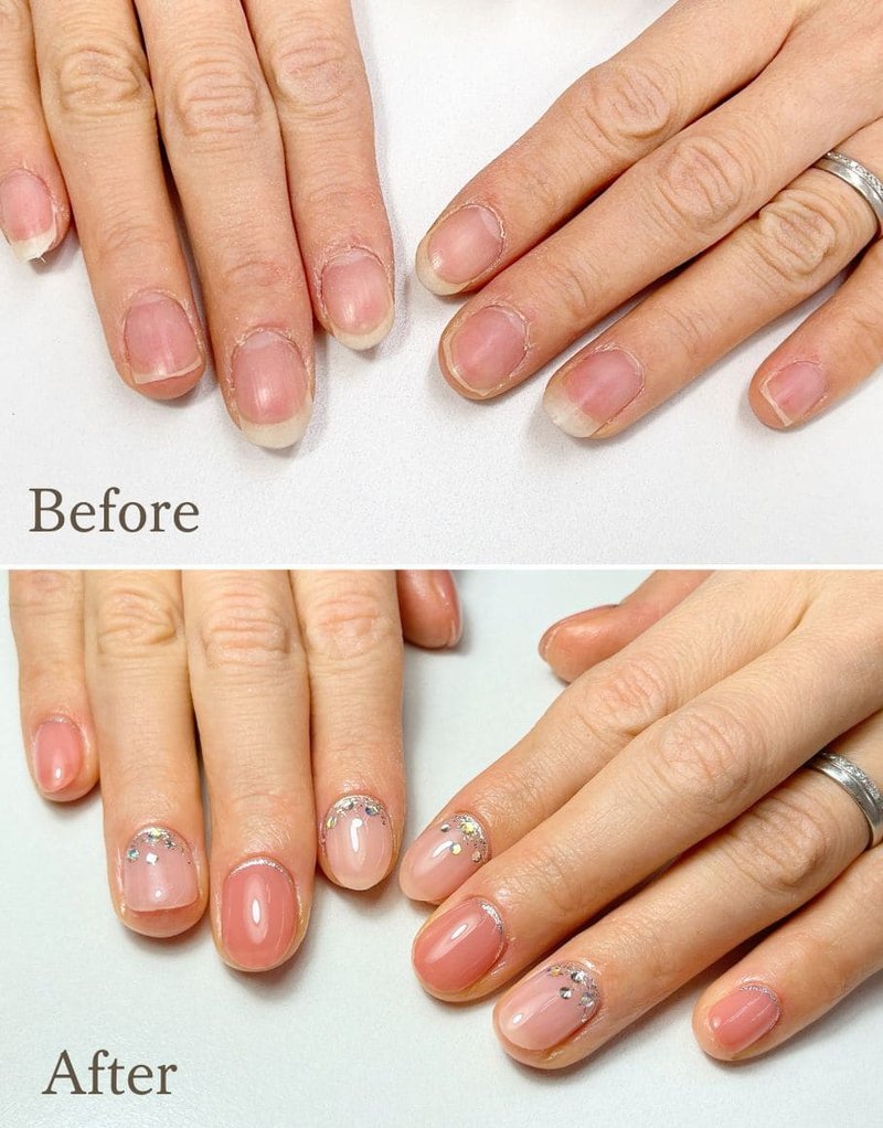 nail salon a.n.cで施術した短い爪の施術前と施術後の比較